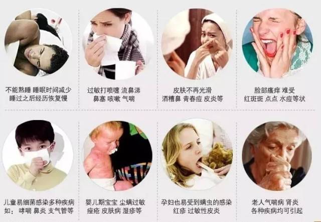 85%的过敏性鼻炎患者对螨虫过敏超过80%的儿童呼吸系统过敏是由螨虫引起的
