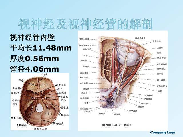 视神经管骨折失明减压术