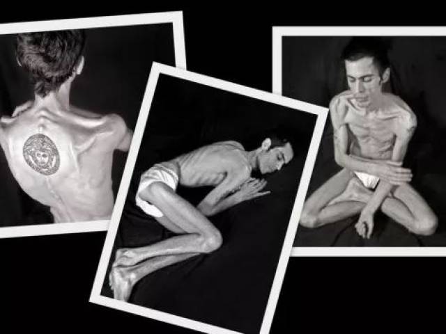 肌肉男模节食减肥丧命,日本减肥名人不吃主食猝死,劝你不要瞎减肥了!