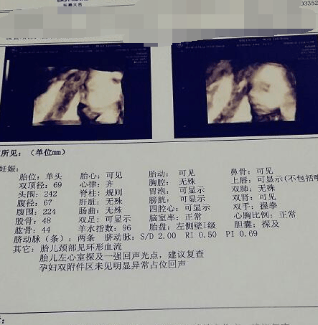 四维单有这些术语时,在暗示妈妈,可能是个帅气男宝