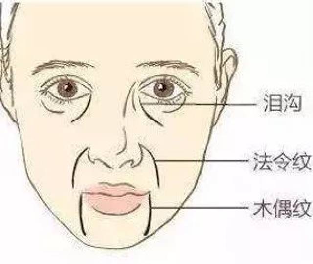 95后林允都开始关注法令纹了,你可千万别不当回事