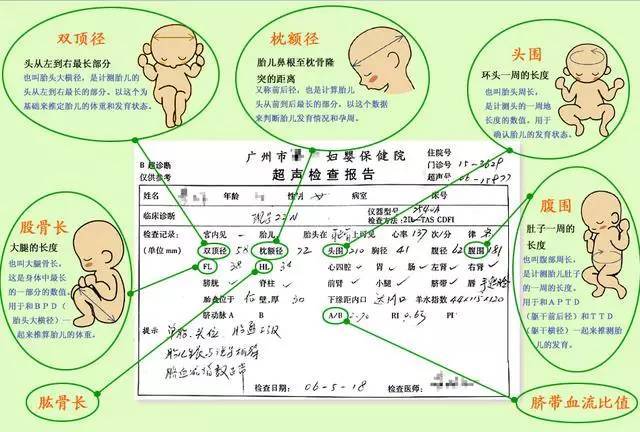 怀孕期间化验的b超单怎么看,上面写的双顶径 枕额径 fl hl a/b 还有