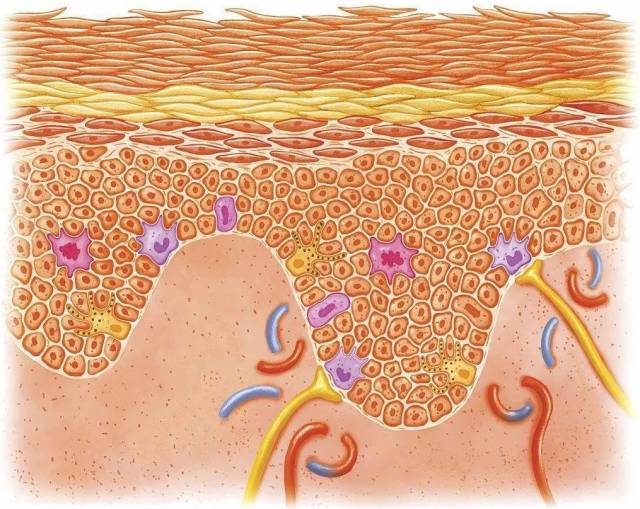 正常皮肤解剖图 常年皮肤发红,一层一层脱屑 那一年的夏天,姑娘终于又
