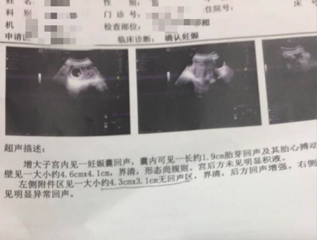 五一假期前生下男宝,胎动,肚型都不准,分享详细孕期男宝症状