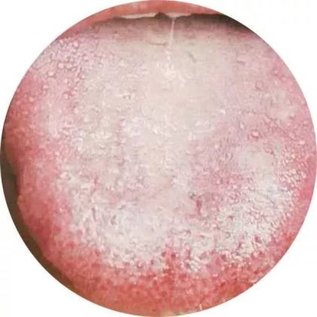 【健康】伸出舌头就知道你是什么体质!