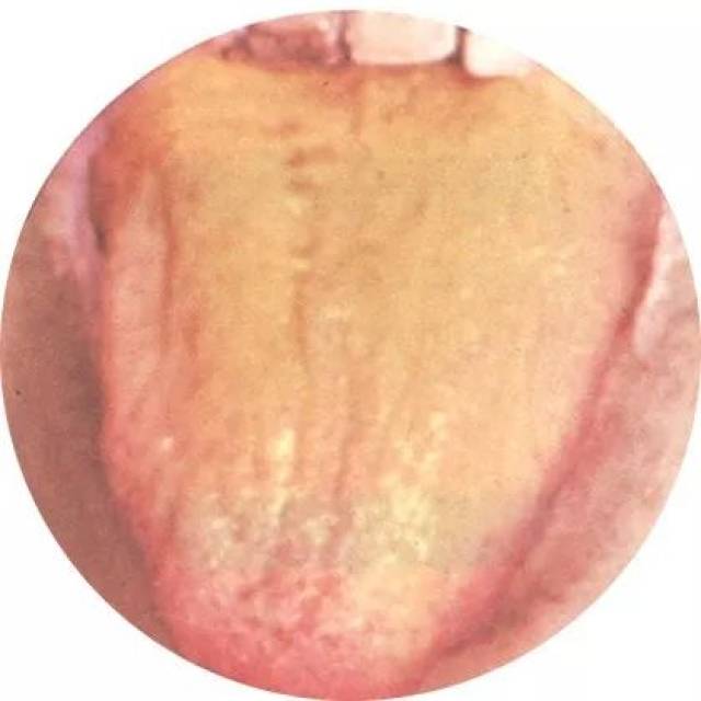 【健康】伸出舌头就知道你是什么体质!