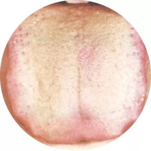 【健康】伸出舌头就知道你是什么体质!