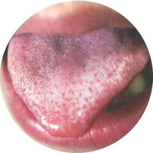 【健康】伸出舌头就知道你是什么体质!