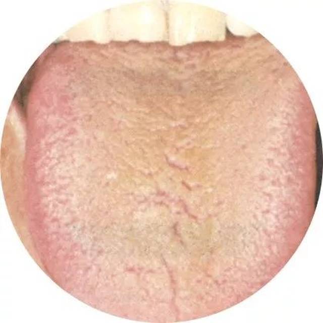 【健康】伸出舌头就知道你是什么体质!