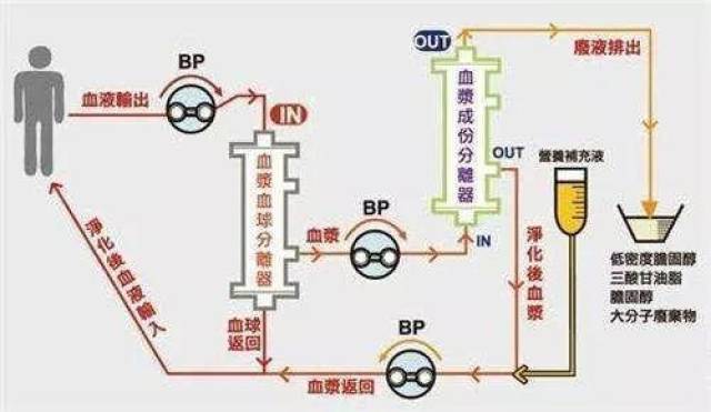 多功能血液净化装置工作原理图 血液净化 是科学,精确管理自己健康的