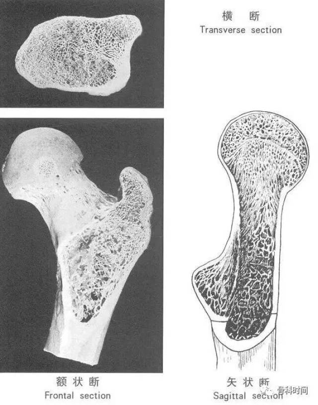 b 前面观 c-e:横断面观 股骨矩股骨矩内段皮质骨结构与股骨颈皮质