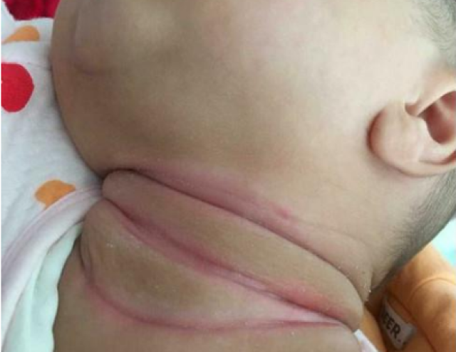 婴儿几个月可以看到脖子 9e3c45c30e9b42919030a1fe6c57ee28.jpg