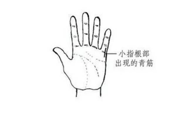 正常人的手部颜色是鲜艳的,手掌部呈淡或粉,润泽光亮,富有