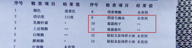 手把手教你看懂孕检后的化验单,及时知道自己和胎儿的