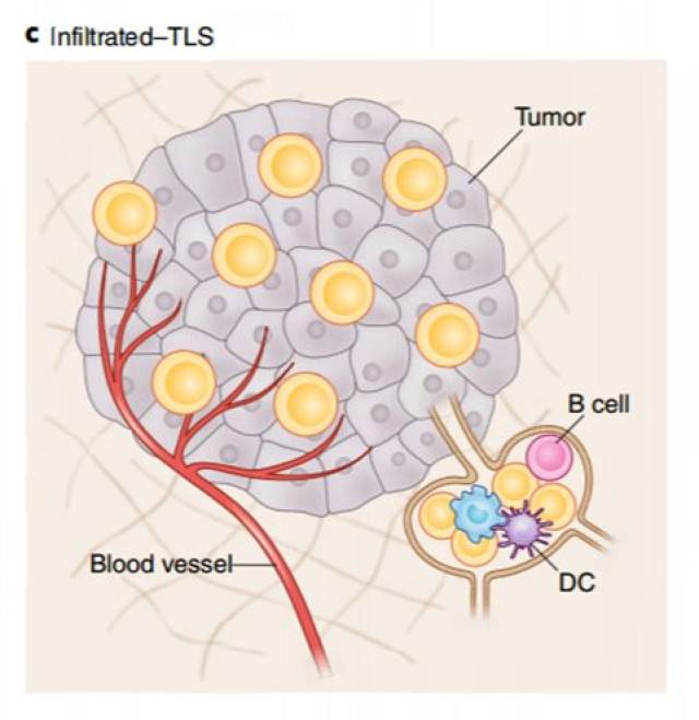 infiltrated–tls(tls-times)