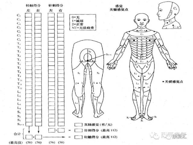 检查身体两侧各自28个皮节的关键感觉点: 0 缺失  1 障碍(部分障碍