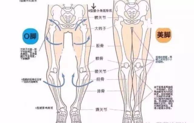 4 经常穿的鞋子只有外侧磨损严重. 5 大腿骨比骨盆
