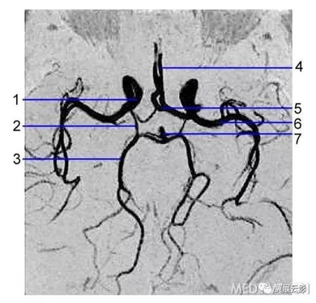 大脑中动脉;7.基底动脉.