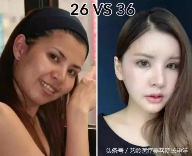 丑女整容40次,最终变成这幅模样,花费700万值不值?