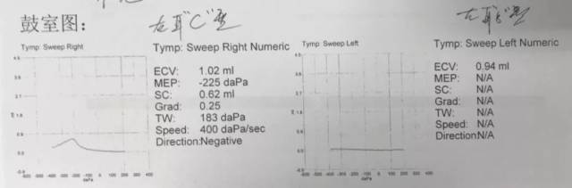 8ml,在正常峰值0.3~1.