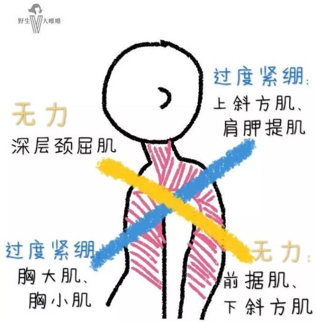 推推眼镜,大唯唯来个名词解释: 上交叉综合征是指由于长时间低头伏案
