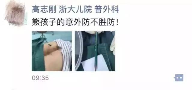 初二小男生,被整支铅笔戳进屁屁!看着好疼