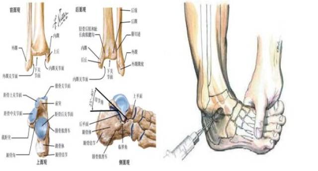 首先我们简单了解下跗骨窦,跗骨窦是位于跟距后关节与前,中关节之间