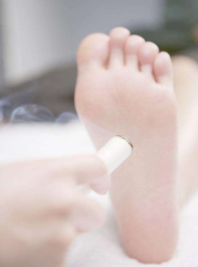 艾灸整个脚底有什么好处?