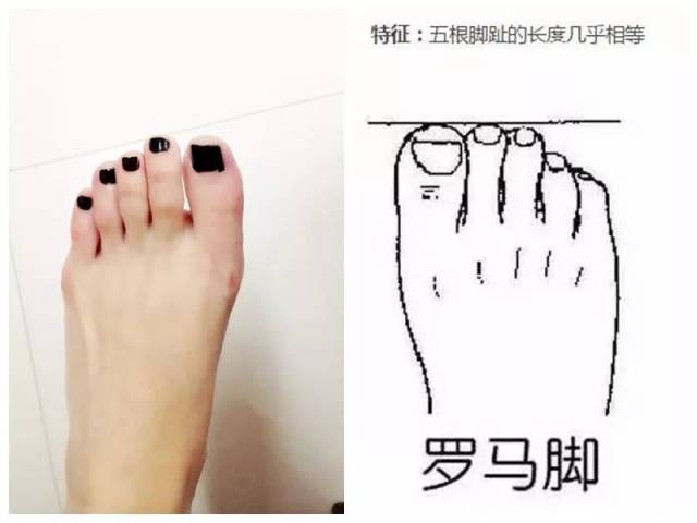 有三种主要的形态:罗马脚,希腊脚,埃及脚.