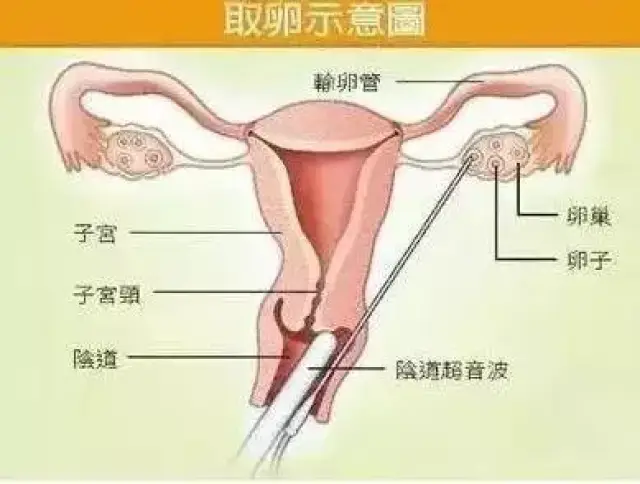 卵巢为女性的性腺,其主要功能是产生卵子并排卵和分泌女性激素,分别