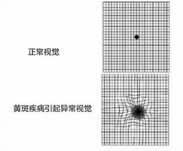 1分钟测出近视散光老花眼