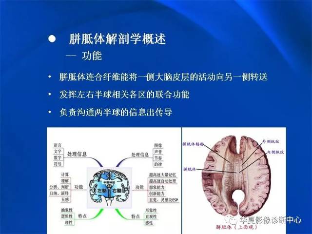 胼胝体解剖及各种病变的影像学表现