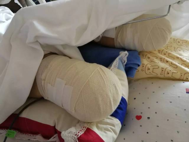 "夕阳红"旅游团山西出车祸 73岁老人双腿截肢被停药