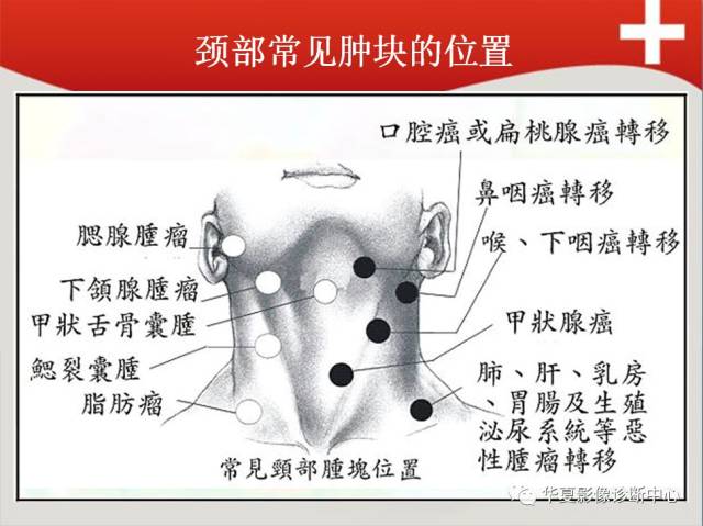 颈部包块的影像签别诊断价值