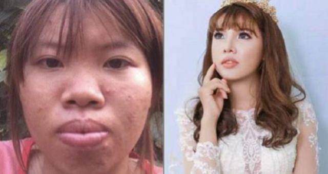 越南22岁丑女花费9万元整容后变成美女,最终嫁给了富二代