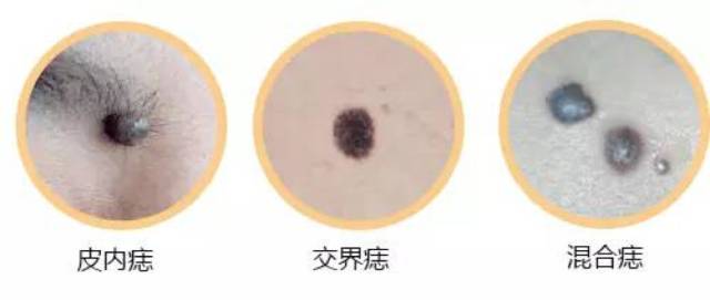 d0815519672942a194062885e8f4496e.jpeg