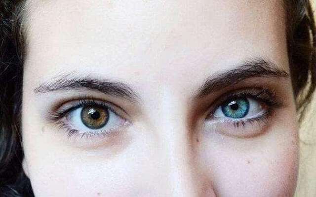 这个美女的眼睛颜色是不同的,一个是黑棕色,一个是天蓝色,据说这位