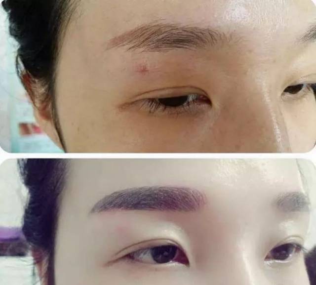 失败的纹眉,纹眼线如何补救?