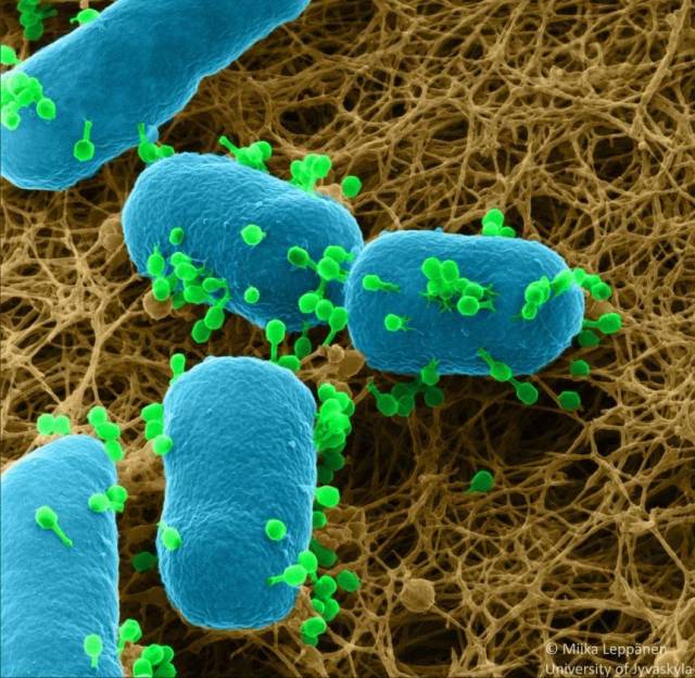 期刊上的研究中,研究了单胞菌,绿脓杆菌的相互作用,它是噬菌体寄生虫