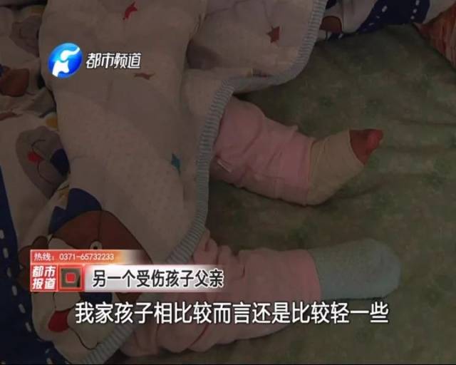 最让闫大娘担心的是,孩子被截肢了,以后该怎么办.