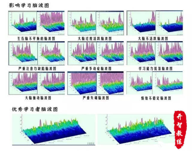 【上势国际脑潜能开发连锁机构】脑波仪测试训练简介