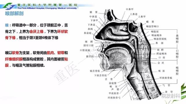 喉部解剖及t分期影像诊断