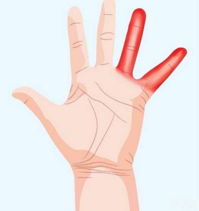 7种手痛都是身体对你发出的讯号,如果不注意可就糟糕了!