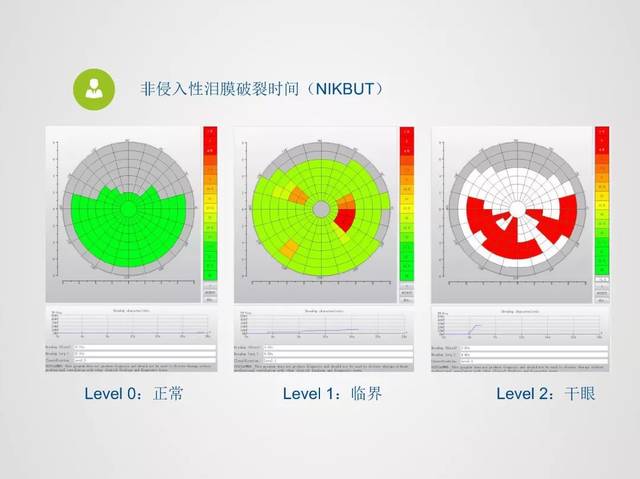 泪河高度正常值 搜狐网