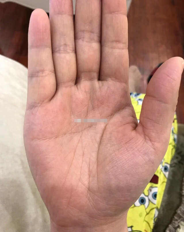 感情线平直且末端分叉,婚姻上有波折,严重会分手离婚