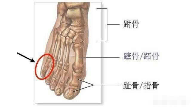 一种说法是:我们中国人的第五趾骨只有2节,而欧美人有3节,所以中国人