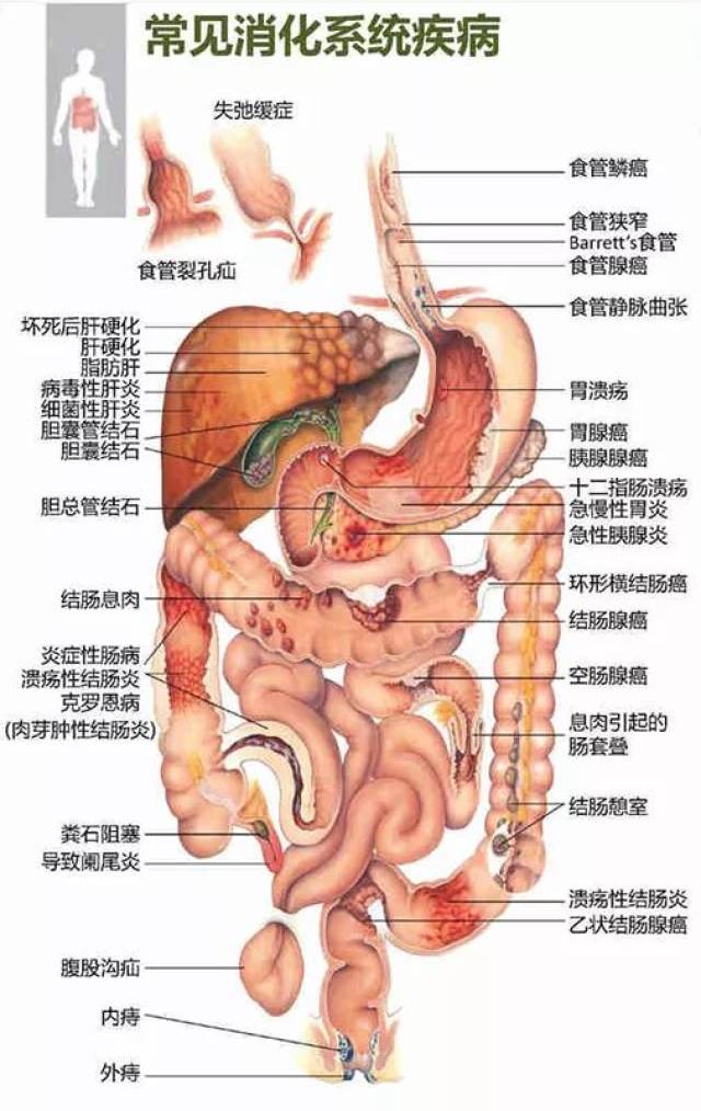 别以为 腹泻,便秘 胀气,急性腹痛等症状都是小问题,那是你的消化系统