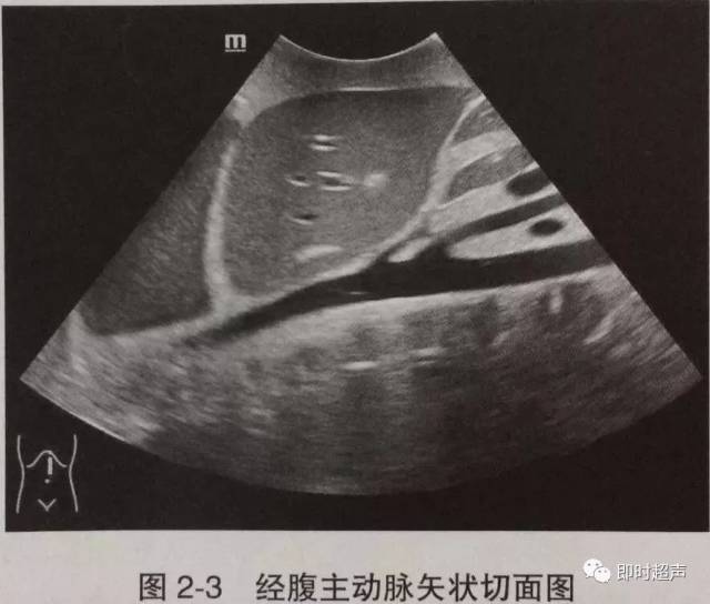 肝脏超声诊断