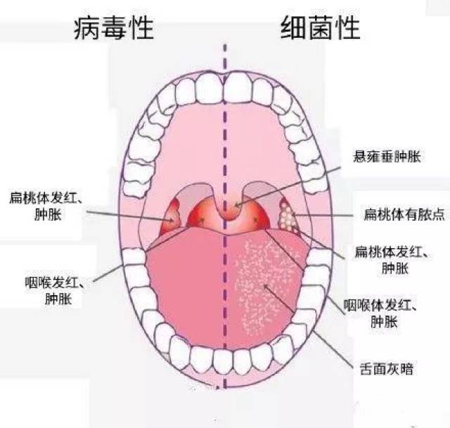 正常人的咽喉实拍图