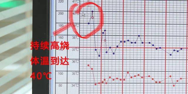 患者入院后的体温变化